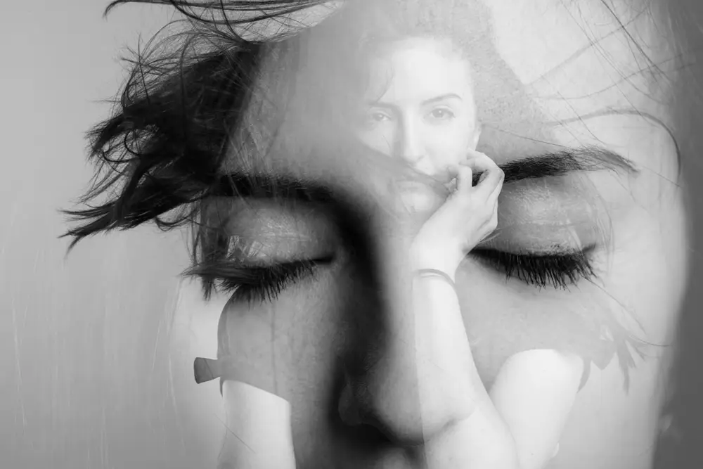 תמונה תיאורית של פנים לדף ניתוחי אף לפני ואחרי